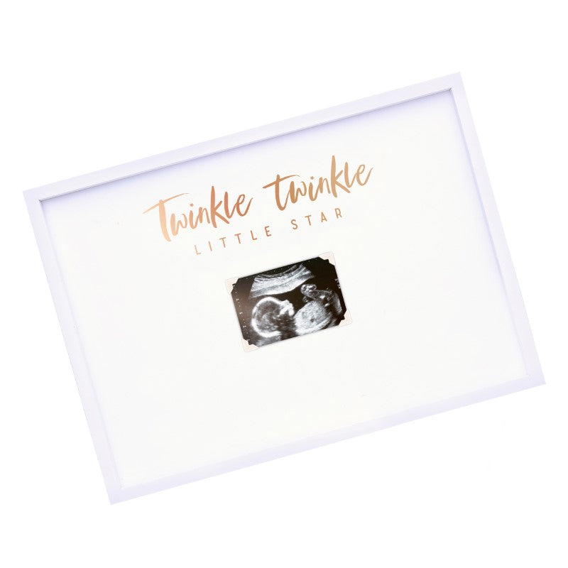 Elegant baby scan frame guest book alternative for displaying photos and guest messages at baby showers, fits nursery decor.